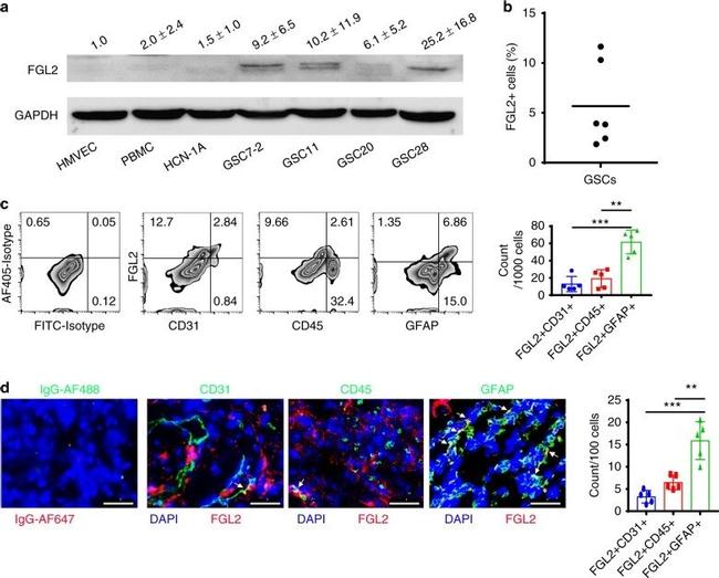 GFAP Antibody in Immunohistochemistry (IHC)