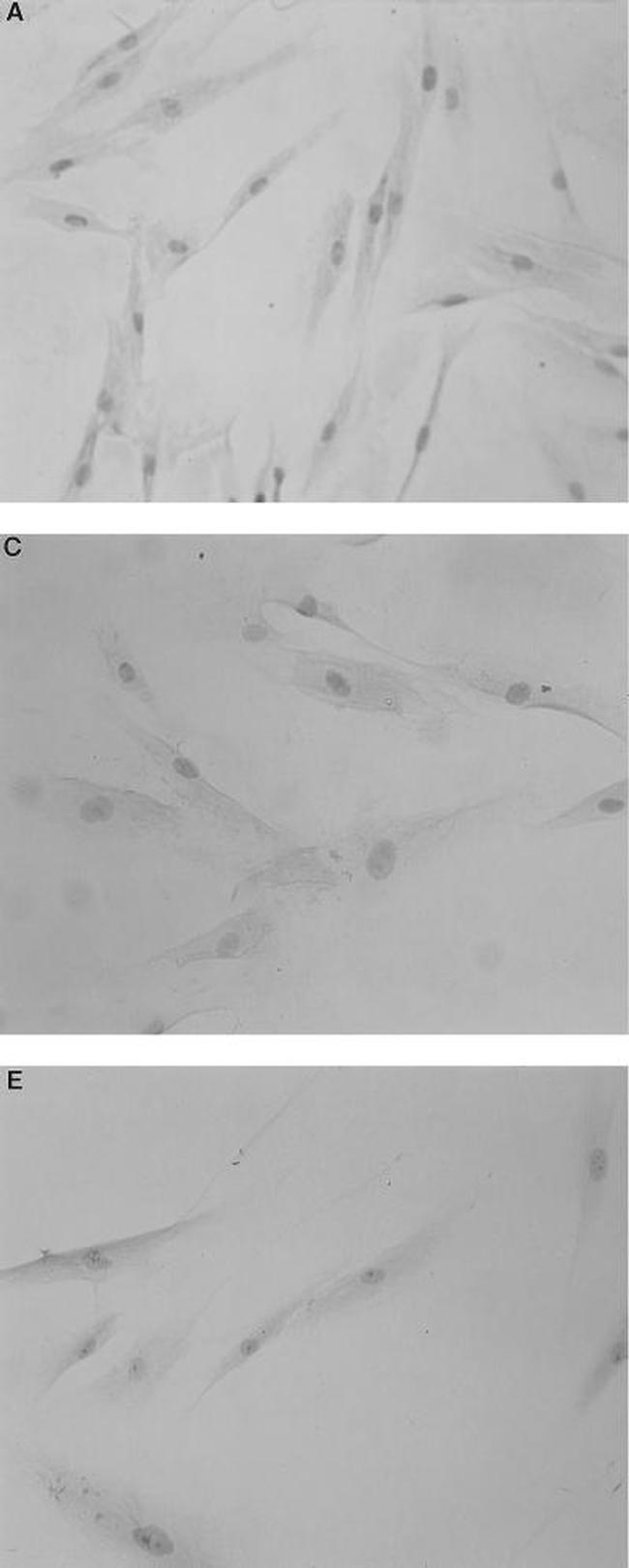 CD284 (TLR4) Antibody in Immunocytochemistry (ICC/IF)