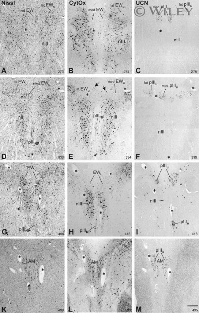 MTCO2 Antibody in Immunohistochemistry (IHC)