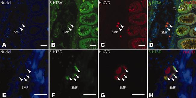 HuC/HuD Antibody in Immunohistochemistry (IHC)