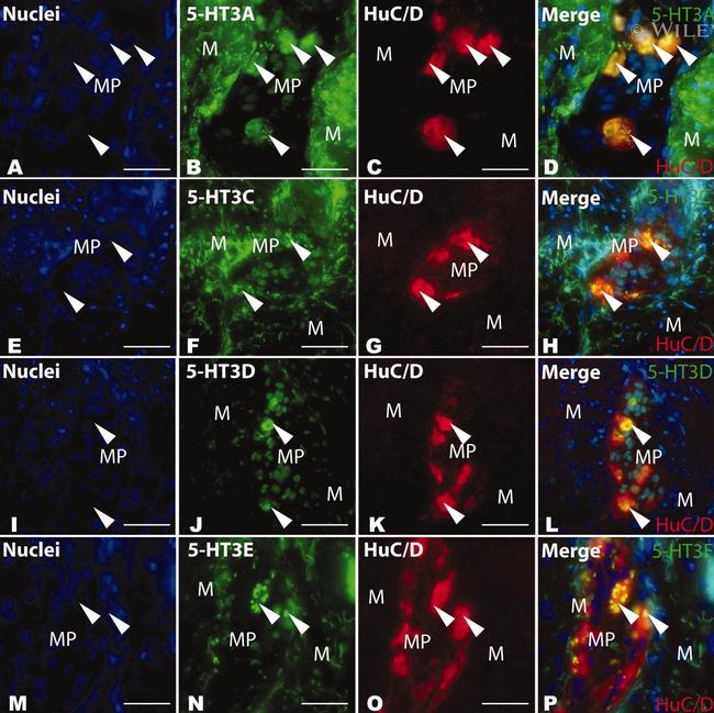 HuC/HuD Antibody in Immunohistochemistry (IHC)