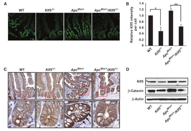 beta Catenin Antibody in Immunohistochemistry (IHC)