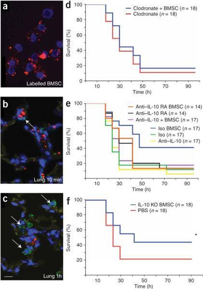 IL-10 Antibody in Neutralization (Neu)