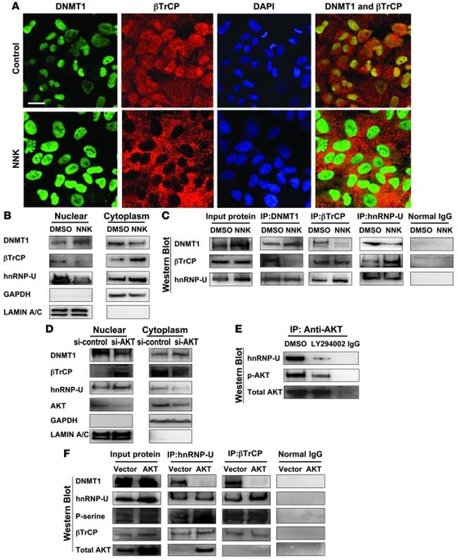 BTRC Antibody