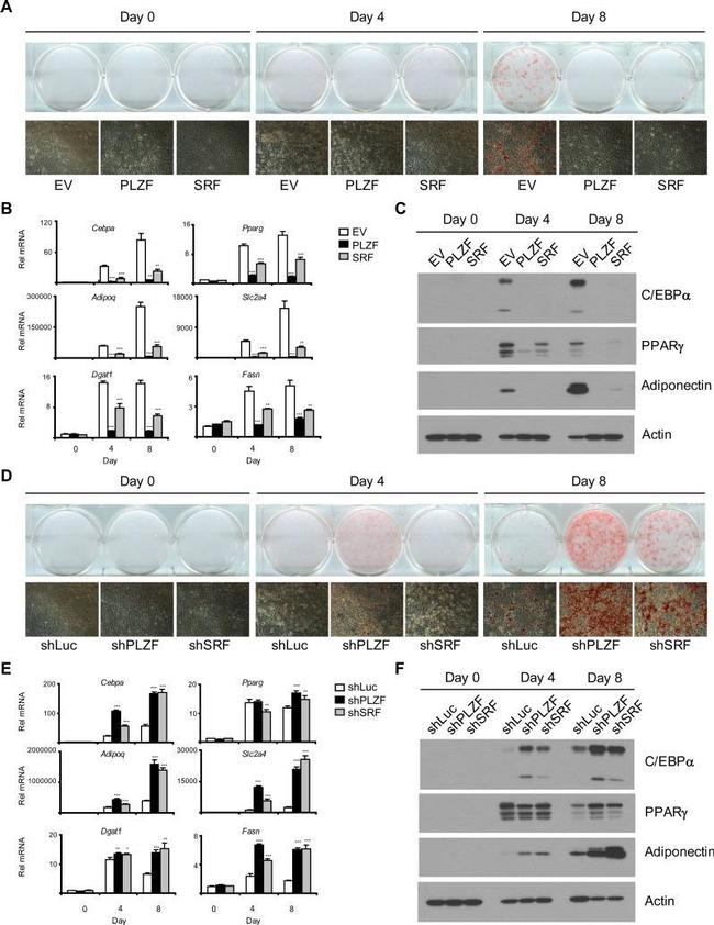 Adiponectin Antibody in Western Blot (WB)