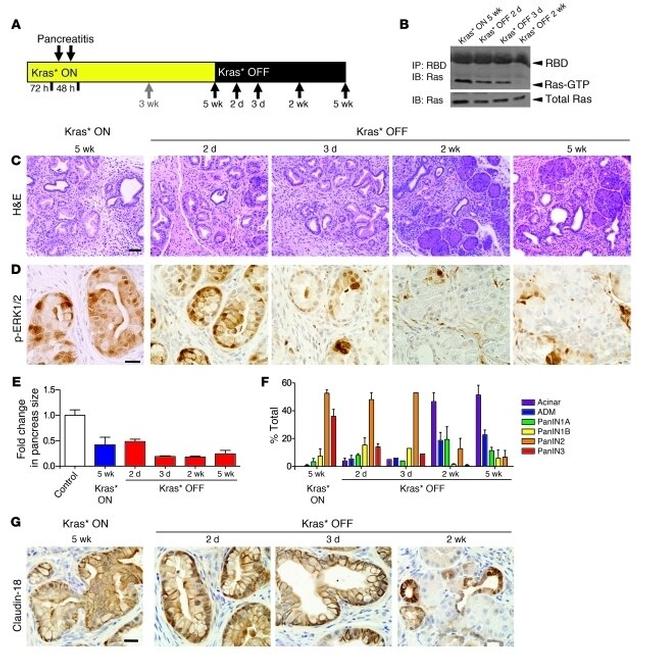 Claudin 18 Antibody in Immunohistochemistry (IHC)