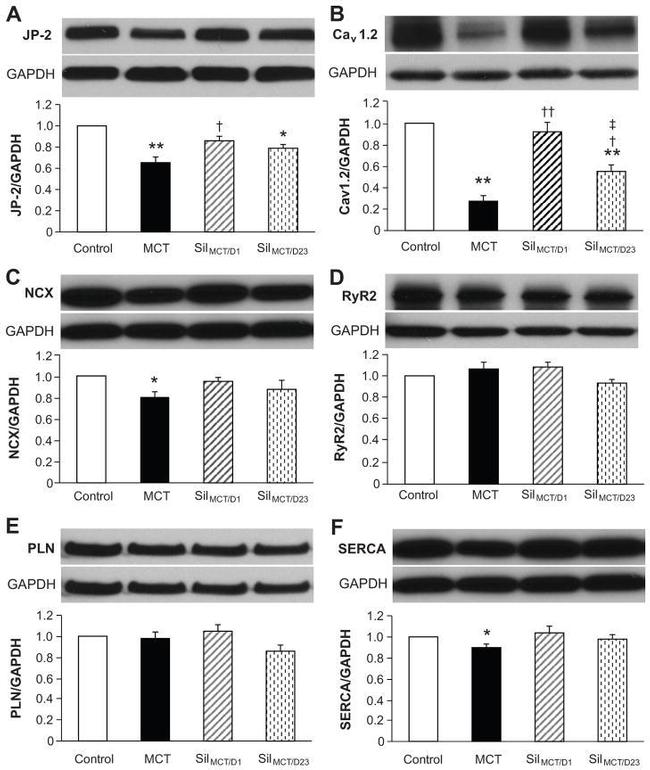 Phospholamban Antibody in Western Blot (WB)