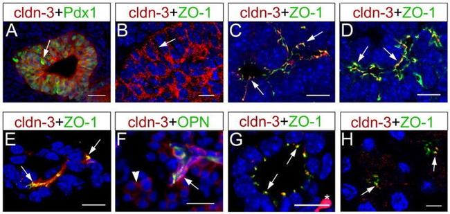 Claudin 3 Antibody in Immunohistochemistry (IHC)