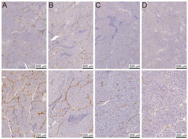 CD34 Antibody in Immunohistochemistry (IHC)