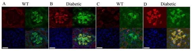 CD140b (PDGFRB) Antibody in Immunohistochemistry (IHC)