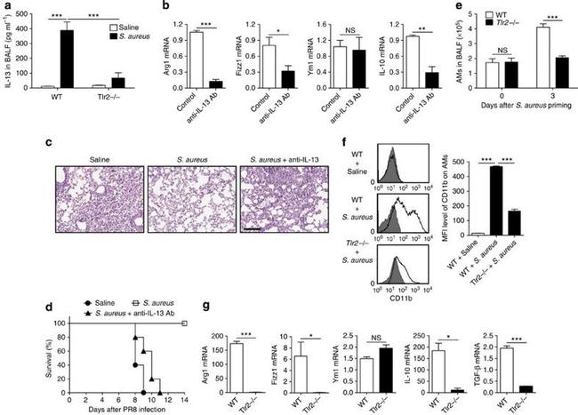 IL-13 Antibody in Neutralization (Neu)