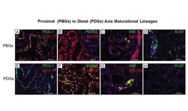 Ki-67 Antibody in Immunohistochemistry (IHC)