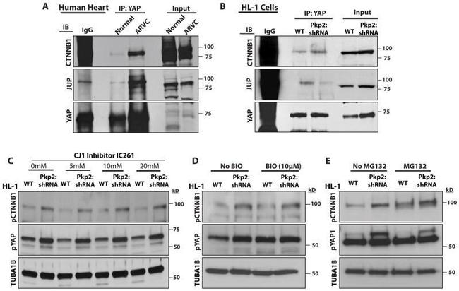 YAP1 Antibody in Immunoprecipitation (IP)