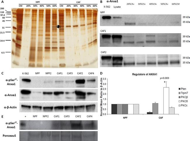 Annexin A1 Antibody in Western Blot (WB)