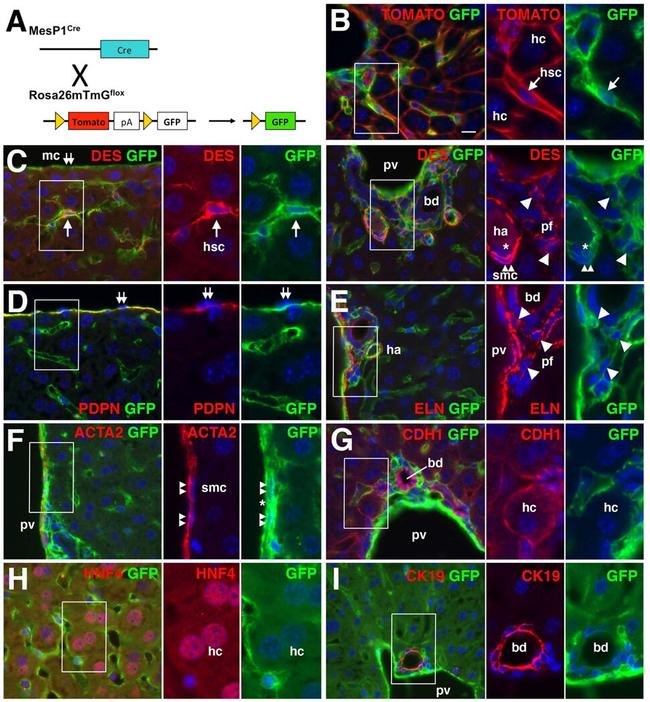 Podoplanin Antibody in Immunohistochemistry (IHC)