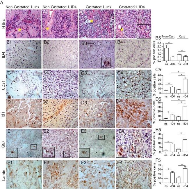 CD31 Antibody in Immunohistochemistry (IHC)