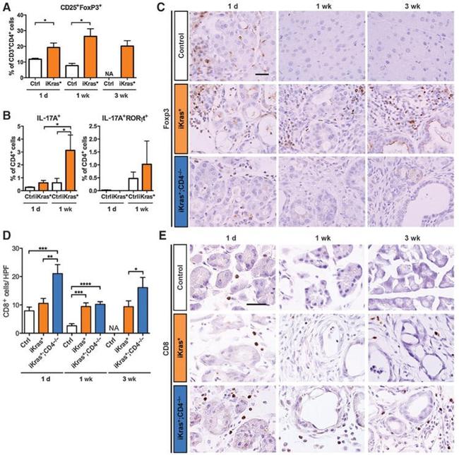 FOXP3 Antibody in Immunohistochemistry (IHC)