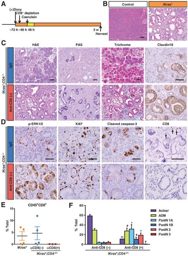 Claudin 18 Antibody in Immunohistochemistry (IHC)