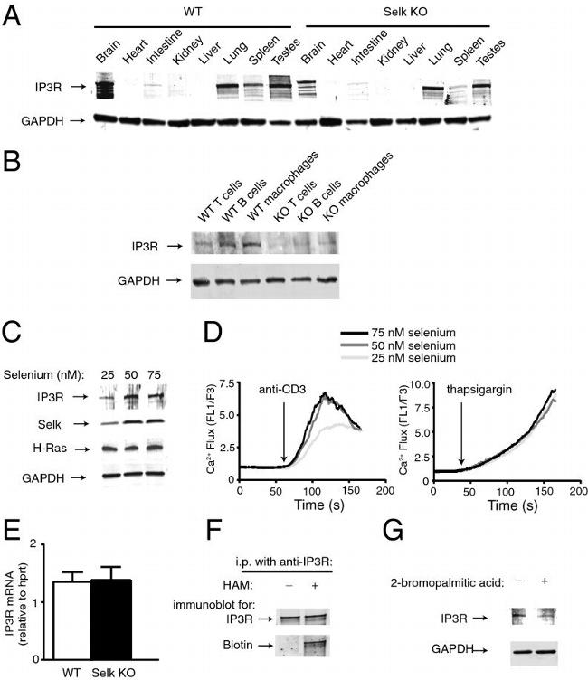 IP3 Receptor 1 Antibody in Immunoprecipitation (IP)