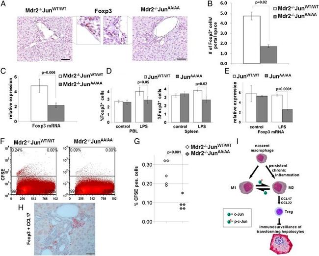 FOXP3 Antibody in Immunohistochemistry (IHC)