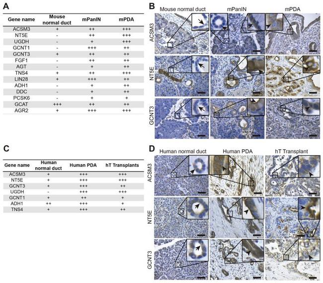 GCNT3 Antibody in Immunohistochemistry (IHC)