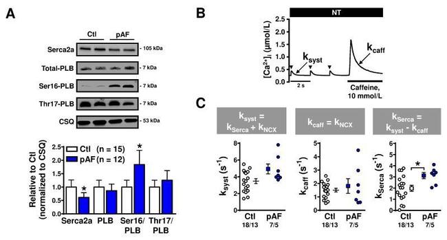 Calsequestrin Antibody in Western Blot (WB)