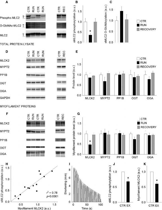 O-linked N-acetylglucosamine (O-GlcNAc) Antibody in Western Blot (WB)