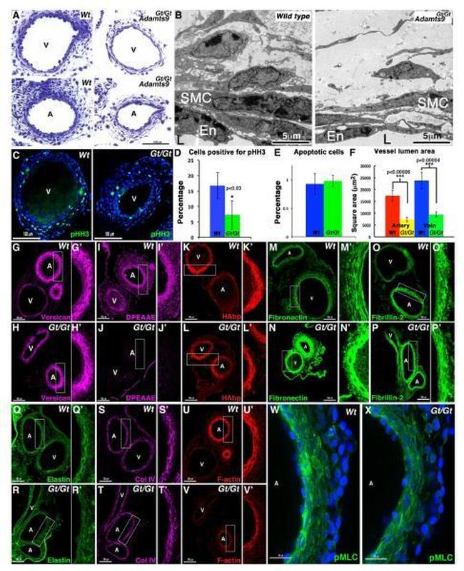 Versican V0, V1 Neo Antibody in Immunohistochemistry (IHC)