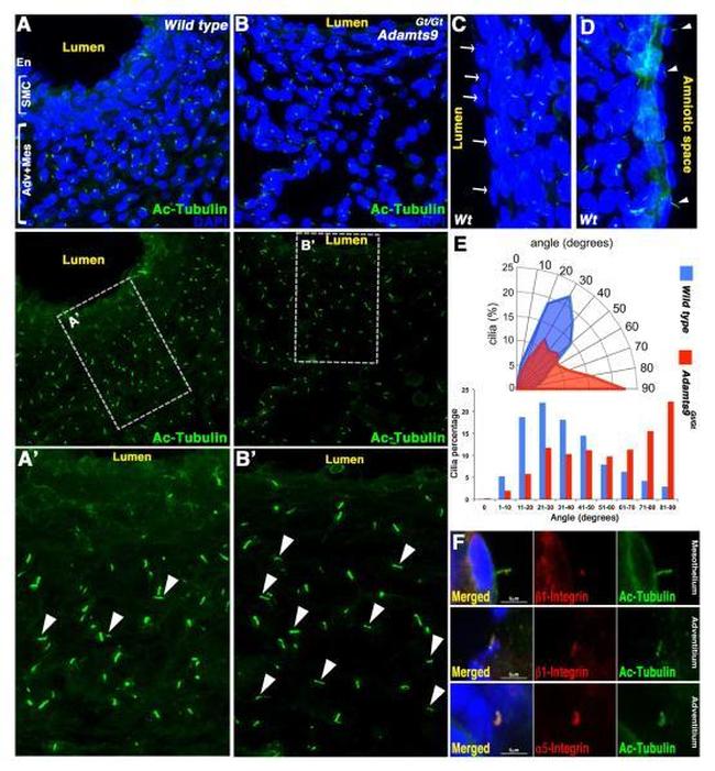 Acetyl-alpha Tubulin (Lys40) Antibody in Immunohistochemistry (IHC)