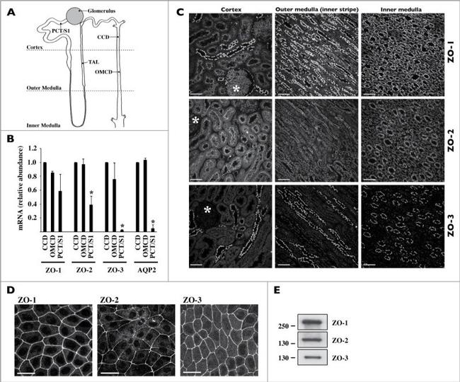 ZO-2 Antibody in Immunohistochemistry (IHC)