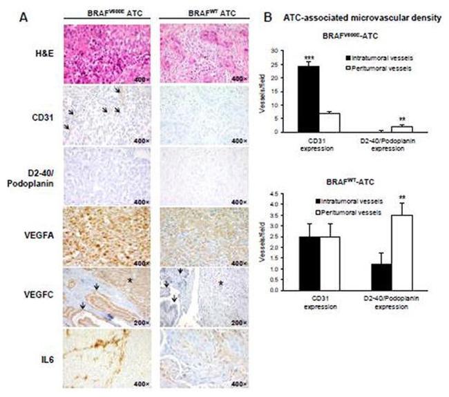 VEGFC Antibody in Immunohistochemistry (IHC)