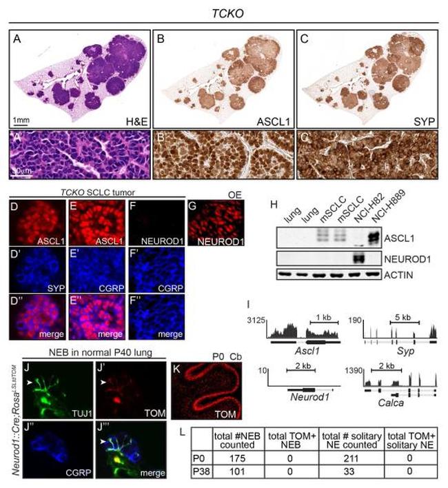 Synaptophysin Antibody in Immunohistochemistry (Paraffin) (IHC (P))