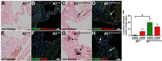 Endomucin Antibody in Immunohistochemistry (IHC)