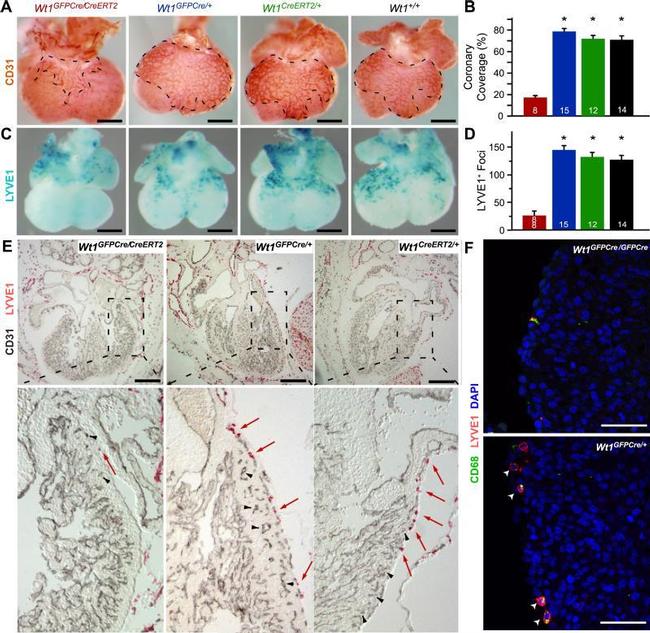 CD68 Antibody in Immunohistochemistry (IHC)