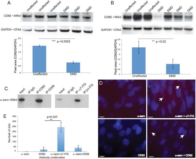 CD82 Antibody in Immunoprecipitation (IP)