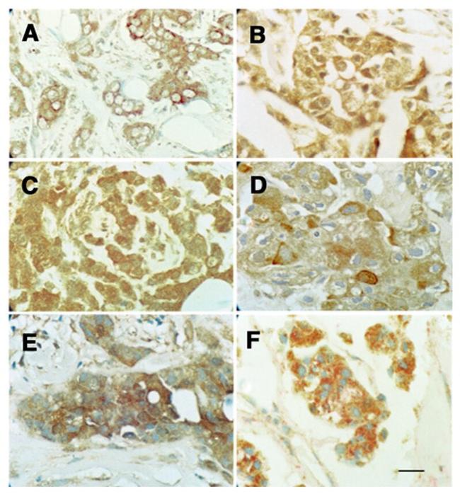 MMP13 Antibody in Immunohistochemistry (IHC)