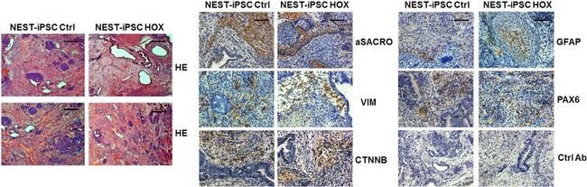 PAX6 Antibody in Immunohistochemistry (IHC)