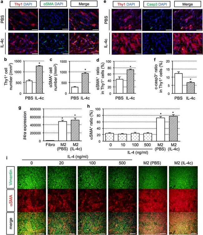 CD90 (Thy-1) Antibody in Immunohistochemistry (IHC)