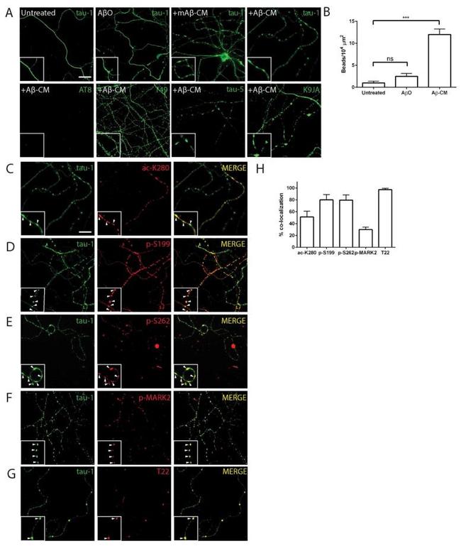 Phospho-Tau (Ser262) Antibody in Immunocytochemistry (ICC/IF)