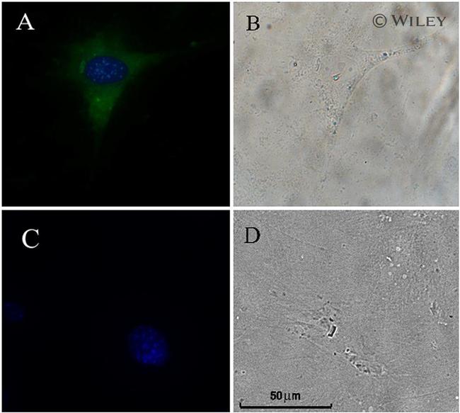 NEFL Antibody in Immunocytochemistry (ICC/IF)