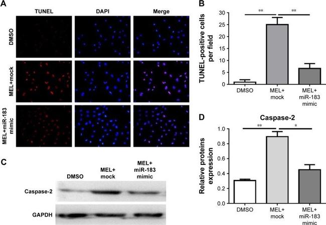 MZB1 Antibody in Western Blot (WB)