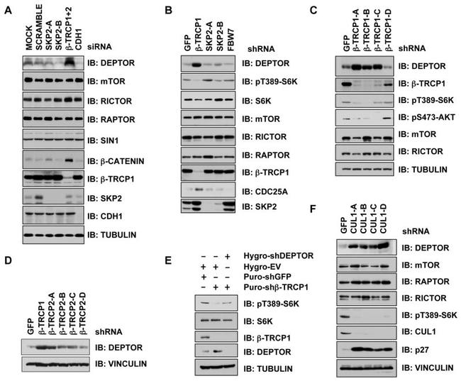 BTRC Antibody in Western Blot (WB)