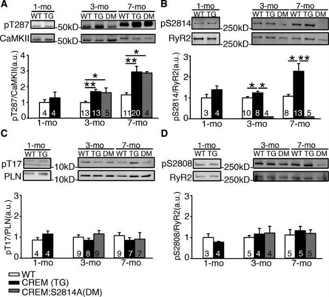 Phospholamban Antibody in Western Blot (WB)