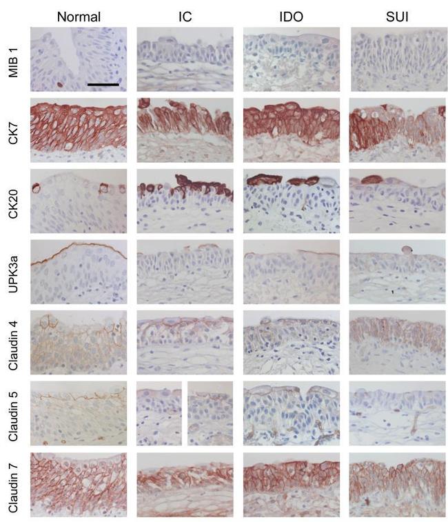 Claudin 7 Antibody in Immunohistochemistry (IHC)