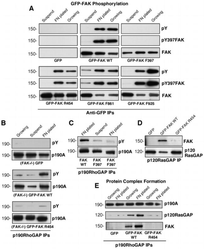 Phospho-FAK (Tyr397) Antibody in Western Blot (WB)