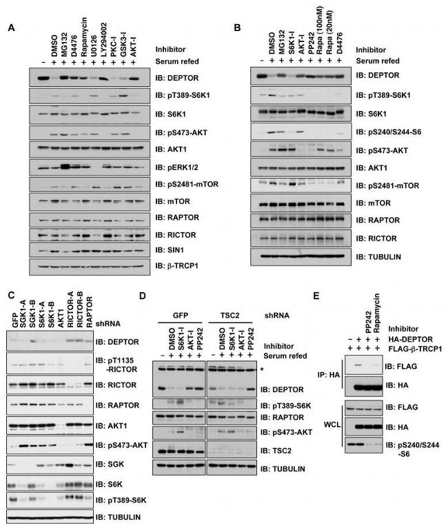 BTRC Antibody in Western Blot (WB)