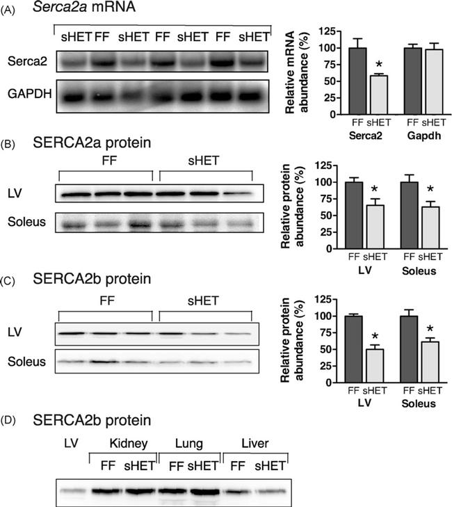 SERCA2 ATPase Antibody in Western Blot (WB)