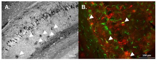 GFAP Antibody in Immunocytochemistry, Immunohistochemistry (ICC/IF, IHC)