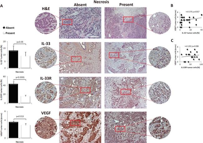 ST2 Antibody in Immunohistochemistry (Paraffin) (IHC (P))