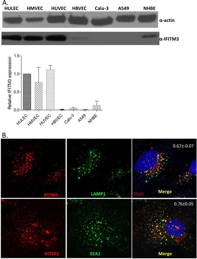 IFITM3 Antibody in Western Blot, Immunocytochemistry (WB, ICC/IF)